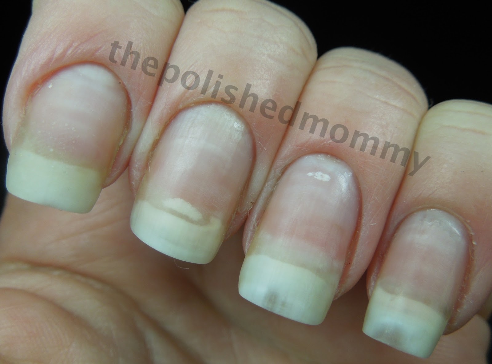 How to Repair a Broken Nail… – The Polished Mommy